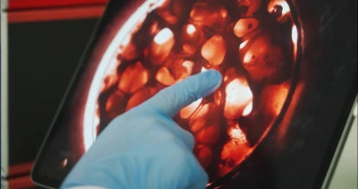 A hand points to a Petri dish
